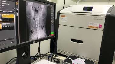 El Municipio sumó un nuevo sistema de digitalización de radiografía y mamografía