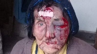 Desfiguraron a golpes a una jubilada de 83 años para robarle