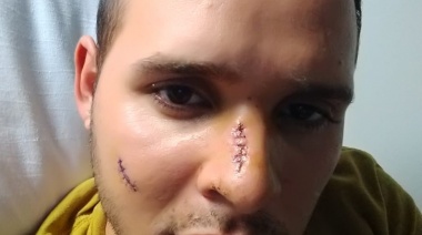 Habló el chofer apuñalado: “Yo me salvé de milagro, pero esa gente salió a matar a sangre fría”