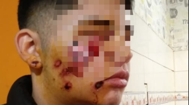 El pedido de la familia del menor que perdió la vista tras un allanamiento erróneo: “Queremos que el policía sea juzgado como una persona común”