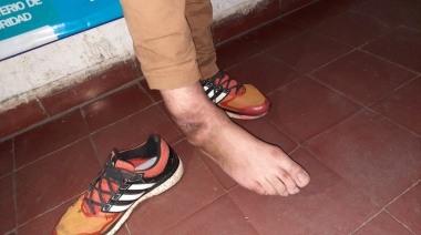 Atraparon a “el Rengo”, el ladrón acusado de abuso que había sido escrachado por vecinos de Longchamps