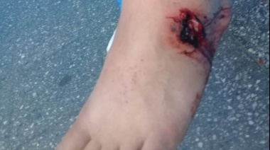 Habló el joven herido por la Policía en una plaza de Lanús: "“Estuve en la comisaría desangrándome"