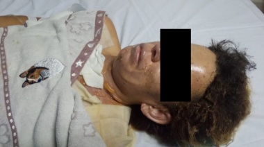 Atacó a golpes a su pareja y la prendió fuego en frente de su hijo
