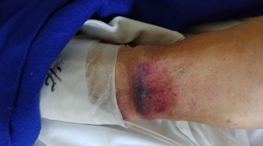 Denunciaron a una enfermera de la Clínica Modelo de Lanús por maltratos