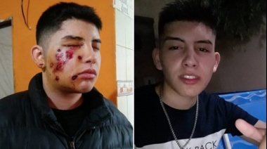 Preocupación por el joven baleado en la cara durante un allanamiento erróneo en Lomas