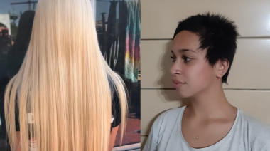 El drama de la joven a la que le quemaron el pelo: “No es justo que le pase esto a ella ni a nadie”