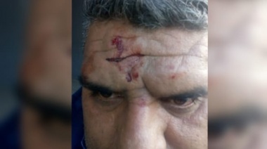 Se negó a pagar el pasaje y atacó a trompadas a un colectivero de la línea 266