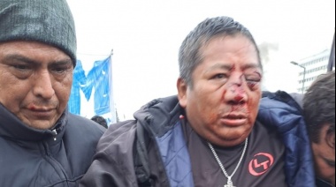 Trabajador municipal perdió un ojo en la represión en Jujuy