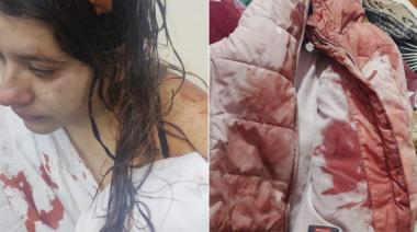 La víctima de "el Loco de la Tenaza": "Quería violarme y matarme"