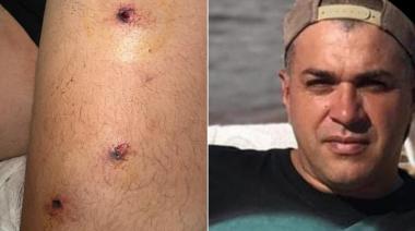 Acribillaron a un hombre por evitar una usurpación: acusan a "mafias" afines al gobierno de Lanús