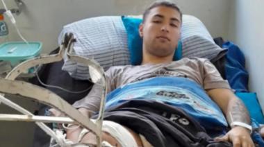 Operaron con exito al delivery atropellado, pero el acusado sigue libre