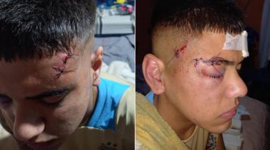 Víctima de una patota en Ezeiza: "Me iban a matar a palos"