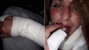 Sobrevivió a varios intentos de asesinato, huyó a España, y no puede regresar: "Si vuelvo, no duro ni..."