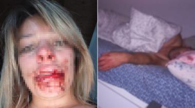 Desfiguró a su novia a trompadas, la dejó ensangrentada, y se acostó a dormir