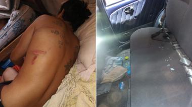 "Guerra de agua" entre vecinos terminó a palazos: "Le bajaron un diente a mi tía"