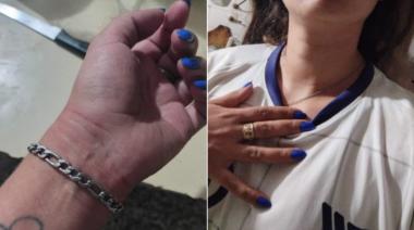 Le reclamó por una infidelidad, pero su ex y su cuñado le dieron una paliza