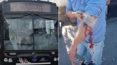 Contradicciones en el chofer de la línea 543 baleado y dudas sobre la versión inicial