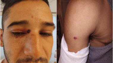 El joven baleado por un subcomisario en Lanús se quiere mudar por miedo