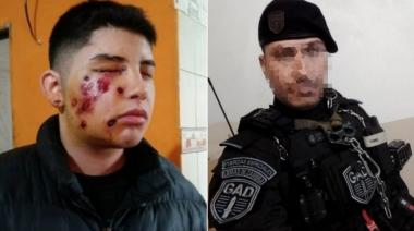 Policía gatillo fácil: se equivocó de casa, le disparó en la cara a un menor, pero no irá preso