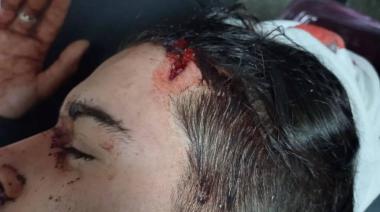 Un vecino amenazó con matarla, prender fuego su casa y atacó a su pareja con una pala