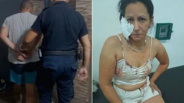 Cayó el acusado de arrancarle la oreja a su pareja: "Ese psicópata no lastima más a nadie"