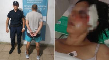 Le arrancó la oreja a su pareja en frente de su hija de 4 años y espera ser juzgado por el brutal ataque