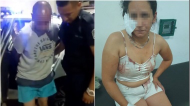 Desfiguró a golpes a su pareja, le arrancó una oreja a mordidas, pero estuvo preso menos de dos meses