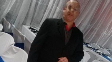 Quiso salvar a su perro de un incendio pero quedó atrapado y ahora pelea por su vida