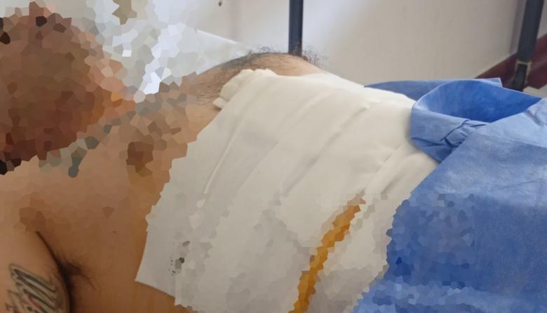 Balearon a un hombre para robarle el auto: "Le dieron cinco tiros de espalda, a matar"