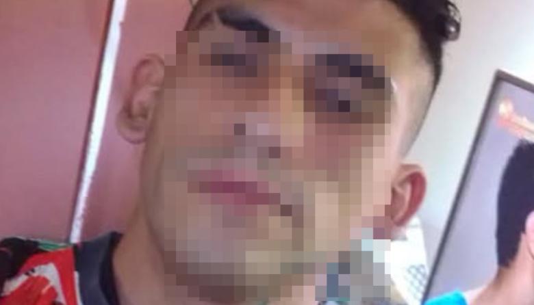 Cayó el presunto autor de un brutal crimen: "Lo apuñaló en el pecho, en la cara y le dibujó una A"