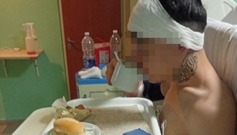 Le dieron el alta al adolescente atacado a botellazos por una patota: buscan identificar a los agresores