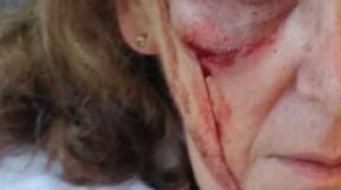 Paciente psiquiátrico golpeó salvajemente a una jubilada en la calle