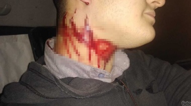 El joven pasajero de la 501 atacado con un cutter repudió la liberación de su agresor