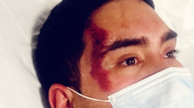 "Patota” de Julián Álvarez denunciada por cobarde ataque a militante de Balladares