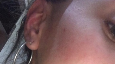 Acusan de agresión al padre del joven que habría abusado de una compañera en una fiesta