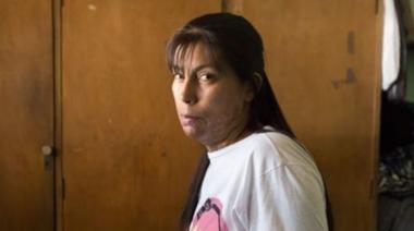 Su novio la prendió fuego delante de sus hijos y busca justicia despues de 12 años