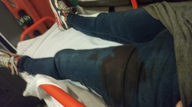 Le rompieron la cabeza a una joven con una tenaza para robarle el celular