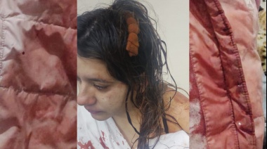 La víctima de "el Loco de la Tenaza": "Quería violarme y matarme"