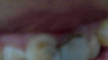 Aseguran que una "dentista falsa" atiende pacientes en un consultorio clausurado
