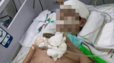 Atacaron a martillazos a un adolescente en Lomas y está muy grave
