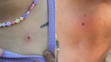 Grave ataque a "balinazos" de un "tirador anónimo" a un grupo artístico que ensayaba en una plaza