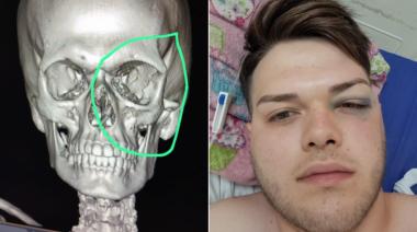 Joven brutalmente agredido, necesita casi 3 millones de pesos para una operación