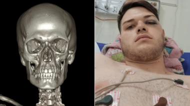 Remisero que le rompió la mandibula de una trompada a un pasajero escapó y está prófugo