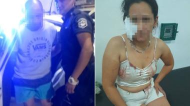Condenaron al ex empleado municipal de Lanús que le arrancó la oreja a su pareja delante de su hija