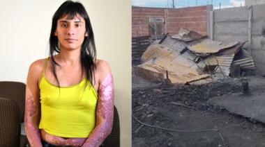 A un año del ataque, Lorena Leiva aún necesita ayuda para su tratamiento