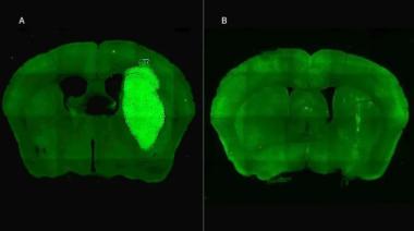 Un avance del CONICET para la lucha contra el cáncer cerebral