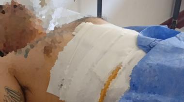 Balearon a un hombre para robarle el auto: "Le dieron cinco tiros de espalda, a matar"