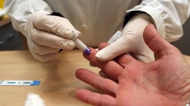Crecen los casos de VIH y sífilis y expertos advierten por un escenario cada vez más complejo