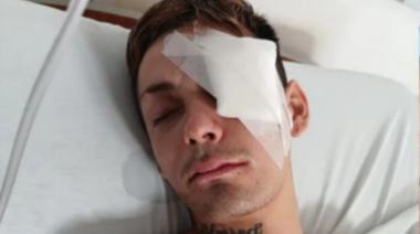 Brutal golpiza a la salida de un boliche: lo tuvieron que operar dos veces, pero no sabe quién le pegó