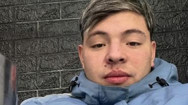 Le dispararon seis veces por un celular y ahora lucha para recuperar la pierna
